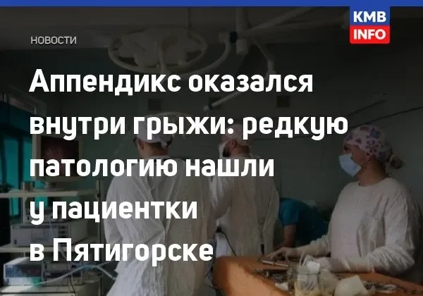 Аппендикс оказался внутри грыжи: редкую патологию нашли у пациентки в Пятигорске